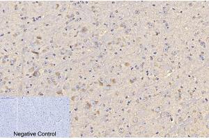 Immunohistochemical analysis of paraffin-embedded mouse brain tissue. (CD4 Antikörper)