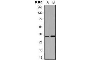 Western blot analysis of CD321 expression in Hela (A), PC12 (B) whole cell lysates. (F11R Antikörper)