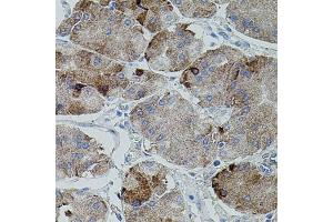 Immunohistochemistry (IHC) image for anti-Amyloid beta (A4) Precursor Protein (APP) (AA 190-290) antibody (ABIN3020680)