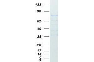 Validation with Western Blot (APP Protein (Transcript Variant 3) (Myc-DYKDDDDK Tag))