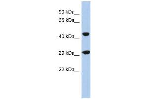 C22ORF25 antibody used at 1 ug/ml to detect target protein. (C22orf25 Antikörper  (N-Term))