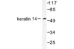 Image no. 1 for anti-Keratin 14 (KRT14) antibody (ABIN265493) (KRT14 Antikörper)