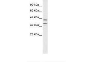 Image no. 1 for anti-One Cut Homeobox 3 (ONECUT3) (C-Term) antibody (ABIN6735852) (ONECUT3 Antikörper  (C-Term))