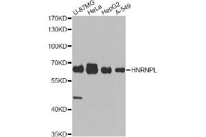 Western blot analysis of extracts of various cell lines, using HNRNPL antibody (ABIN5974591) at 1/1000 dilution. (HNRNPL Antikörper)