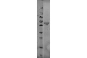 SDS-PAGE of OspC Control Protein. (OspC Protein)