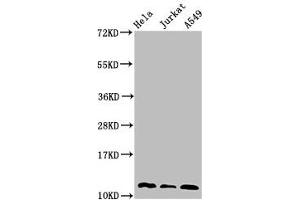 Western Blot Positive WB detected in: Hela whole cell lysate, Jurkat whole cell lysate, A549 whole cell lysate All lanes: TXN antibody at 3 μg/mL Secondary Goat polyclonal to rabbit IgG at 1/50000 dilution Predicted band size: 12, 10 kDa Observed band size: 12 kDa (TXN Antikörper  (AA 2-105))