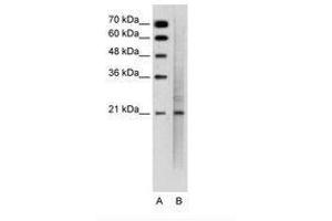 Image no. 2 for anti-Mucin 1 (MUC1) (C-Term) antibody (ABIN6736343) (MUC1 Antikörper  (C-Term))