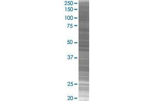 GYPA transfected lysate. (GYPA 293T Cell Transient Overexpression Lysate(Denatured))