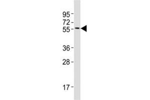 Western blot testing of MITF antibody at 1:2000 dilution + A375 lysate (MITF Antikörper  (AA 1-28))