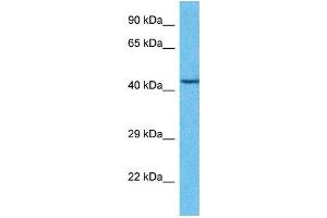 Host:  Rabbit  Target Name:  IRX2  Sample Type:  Esophagus Tumor lysates  Antibody Dilution:  1. (IRX2 Antikörper  (Middle Region))