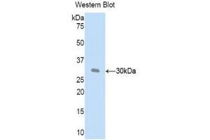 Western blot analysis of recombinant Mouse CFD. (Adipsin Antikörper  (AA 1-259))