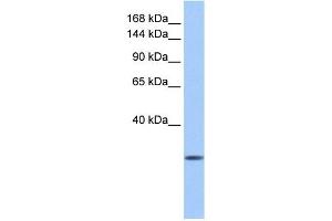 Calmin antibody used at 1 ug/ml to detect target protein. (CLMN Antikörper)