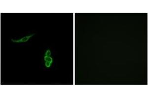 Immunofluorescence analysis of A549 cells, using SCNN1D Antibody. (SCNN1D Antikörper  (AA 411-460))