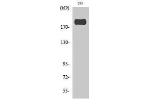 Western Blotting (WB) image for anti-Insulin Receptor Substrate 1 (IRS1) (pSer307) antibody (ABIN3172917) (IRS1 Antikörper  (pSer307))