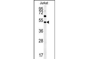SSN1 Antibody (Center) (ABIN652058 and ABIN2840526) western blot analysis in Jurkat cell line lysates (35 μg/lane). (SAMSN1 Antikörper  (AA 255-283))