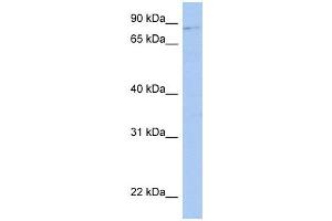 LRRC33 antibody used at 1 ug/ml to detect target protein. (LRRC33 Antikörper  (Middle Region))