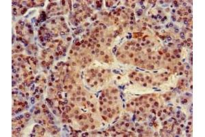 Immunohistochemistry of paraffin-embedded human pancreatic tissue using ABIN7173455 at dilution of 1:100 (TRIM5 Antikörper  (AA 1-493))