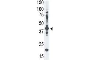 Western Blotting (WB) image for anti-Melanoma Antigen Family A, 4 (MAGEA4) antibody (ABIN3002532) (MAGEA4 Antikörper)