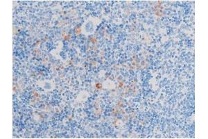 ABIN6267553 at 1/200 staining Mouse spleen tissue sections by IHC-P. (LIMK-1/2 (pThr505), (pThr508) Antikörper)