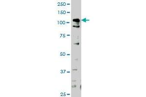 HIPK1 monoclonal antibody (M04), clone 1F2 Western Blot analysis of HIPK1 expression in HeLa . (HIPK1 Antikörper  (AA 330-430))