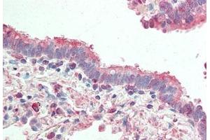 Human Lung, Respiratory Epithelium: Formalin-Fixed, Paraffin-Embedded (FFPE) (ATG4B Antikörper)