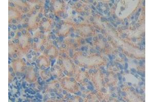 DAB staining on IHC-P; Samples: Rat Kidney Tissue (DGKG Antikörper  (AA 287-524))