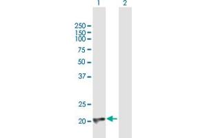 Western Blot analysis of CBFB expression in transfected 293T cell line by CBFB MaxPab polyclonal antibody. (CBFB Antikörper  (AA 1-187))