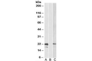 Western blot testing of HEK293 lysate overexpressing human CST8-MYC probed with Cystatin 8 antibody [0. (CST8 Antikörper)