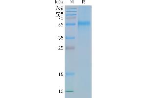 CCR9 Protein