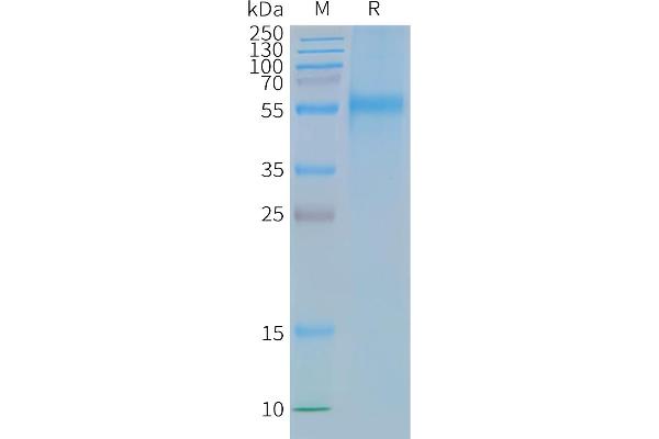 CCR9 Protein