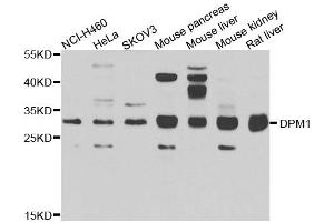 Western blot analysis of extracts of various cell lines, using DPM1 antibody. (DPM1 Antikörper  (AA 1-260))