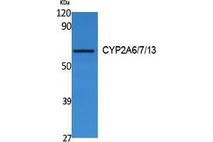 Western Blotting (WB) image for anti-CYP2A6/7/13 (Internal Region) antibody (ABIN3180978) (CYP2A6/7/13 (Internal Region) Antikörper)