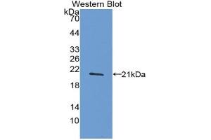 Western blot analysis of the recombinant protein. (TNF alpha Antikörper  (AA 78-234))