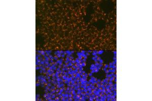 Immunofluorescence analysis of Jurkat cells using CCR8 Rabbit mAb (ABIN1683150, ABIN3018779, ABIN3018780 and ABIN7101661) at dilution of 1:100 (40x lens). (CCR8 Antikörper)