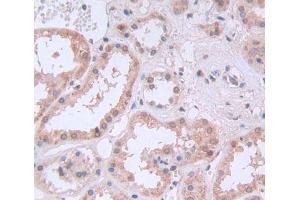 Used in DAB staining on fromalin fixed paraffin- embedded Kidney tissue (PTBP1 Antikörper  (AA 1-531))