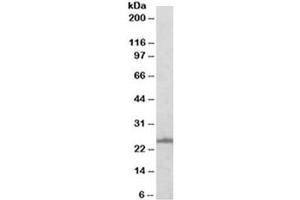 Western blot testing of A431 with RAN antibody at 0. (RAN Antikörper)