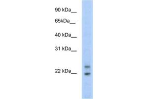 Western Blotting (WB) image for anti-Cytoplasmic Polyadenylated Homeobox (CPHX) antibody (ABIN2461548) (CPHX Antikörper)