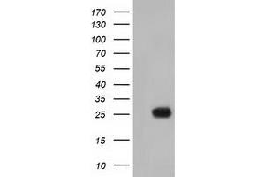 Western Blotting (WB) image for anti-MOB Kinase Activator 3B (MOB3B) antibody (ABIN1499534) (MOBKL2B Antikörper)