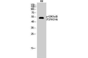 Western Blotting (WB) image for anti-Glycogen Synthase Kinase 3 alpha/beta (GSK3a/b) (pTyr216), (pTyr279) antibody (ABIN3182022) (GSK3 alpha/beta Antikörper  (pTyr216, pTyr279))