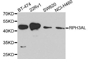 Western blot analysis of extracts of various cell lines, using RPH3AL antibody (ABIN5974449) at 1/1000 dilution. (RPH3AL Antikörper)