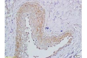 Immunohistochemistry (Paraffin-embedded Sections) (IHC (p)) image for anti-Follicle Stimulating Hormone Receptor (FSHR) (AA 201-300) antibody (ABIN729508)