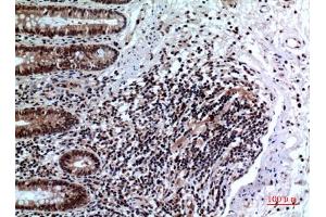 Immunohistochemical analysis of paraffin-embedded human-colon, antibody was diluted at 1:100. (FOXP3 Antikörper  (C-Term))