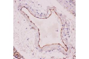 Anti-ACE Picoband antibody,  IHC(P): Rat Lung Tissue (Angiotensin I Converting Enzyme 1 Antikörper  (AA 651-864))