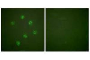 Immunofluorescence analysis of COS7 cells, using Ki67antibody. (Ki-67 Antikörper  (C-Term))
