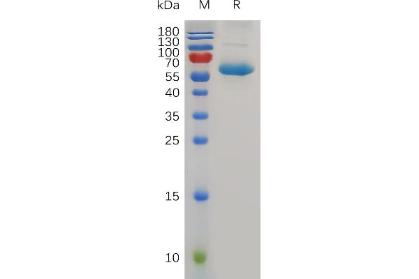 CD72 Protein (Fc Tag)