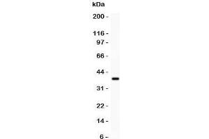 Western blot testing of FHIT antibody and recombinant human protein (0. (FHIT Antikörper  (AA 1-147))