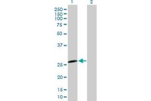 Western Blot analysis of IL6 expression in transfected 293T cell line by IL6 MaxPab polyclonal antibody. (IL-6 Antikörper  (AA 1-212))