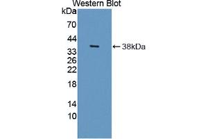 Western blot analysis of the recombinant protein. (HSD17B12 Antikörper  (AA 1-312))