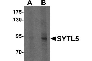 Western blot analysis of SYTL5 in Hela cell lysate with SYTL5 antibody at (A) 1 and (B) 2 µg/mL . (SYTL5 Antikörper  (N-Term))