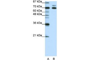 WB Suggested Anti-TRIM16 Antibody Titration:  1. (TRIM16 Antikörper  (N-Term))